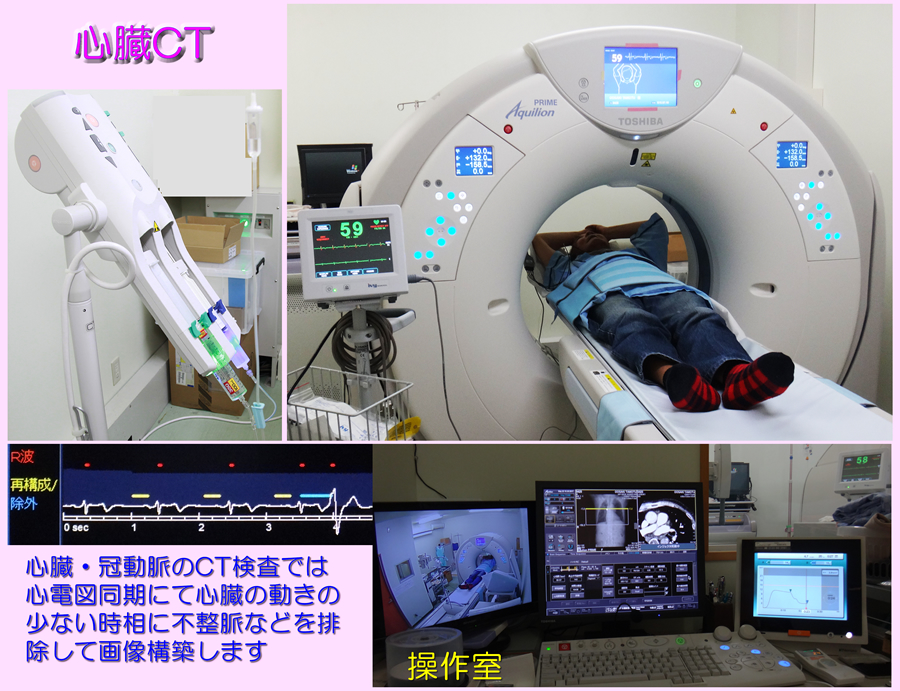 心臓CT検査