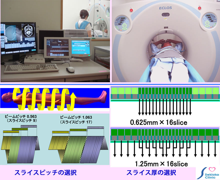MDCT　装置・原理