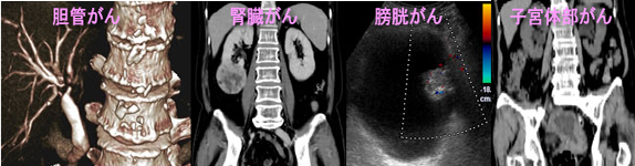 癌診断画像