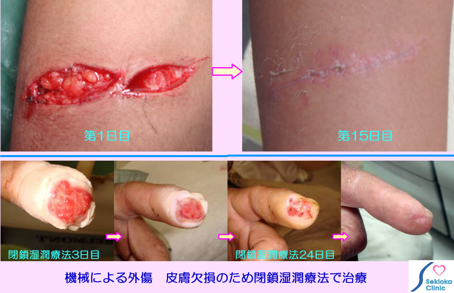 外傷治療例