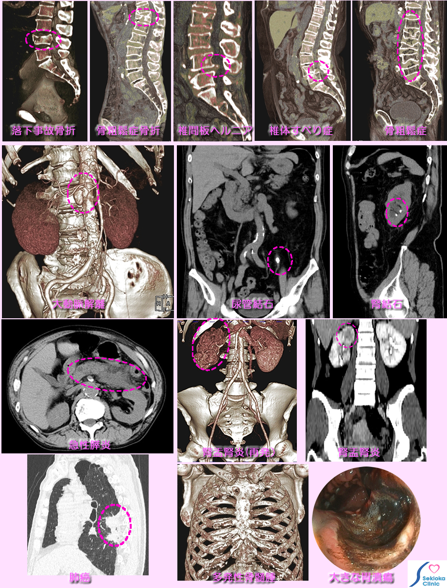 腰痛・背部痛を生じる原因